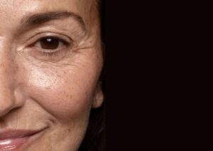 Close-up of an older woman's face showing age spots, fine lines, and skin texture around the eye and cheek area.